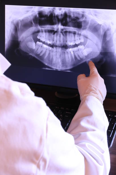 Best Tooth Infection Emergency Dentist  in Jena, LA