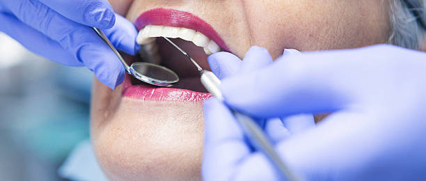 Best Root Canal Emergency Dentist  in Jena, LA