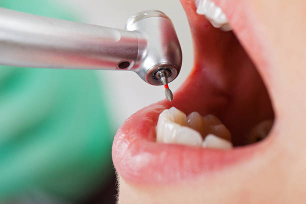 Best Urgent Tooth Repair  in Jena, LA